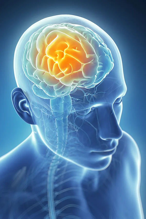 Migraine-Treatment 3D illustration of the brain with glowing pain center. Tanya Zboril, NP of TBT Medical treats migraines using functional medicine in Halifax.