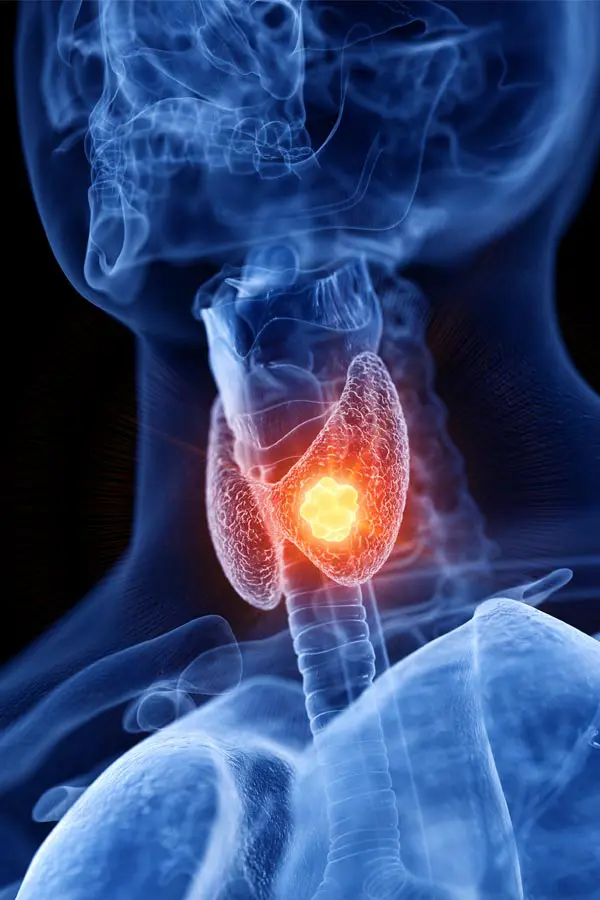 Thyroid-Imbalance-Treatment A 3D illustration of an x-ray of a human neck, highlighting the thyroid. Get help with thyroid imbalance from Tanya Zboril, NP of TBT Medical in Halifax.